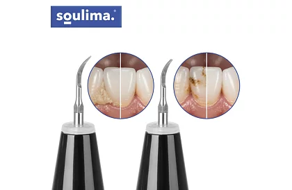 Ultrazvukový odstraňovač zubního kamene + příslušenství